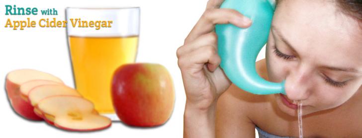 rinsing with apple cider vinegar