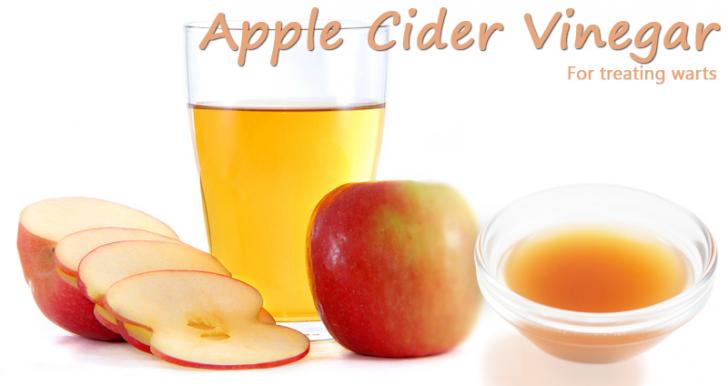 Use of Apple Cider Vinegar to Treat Warts